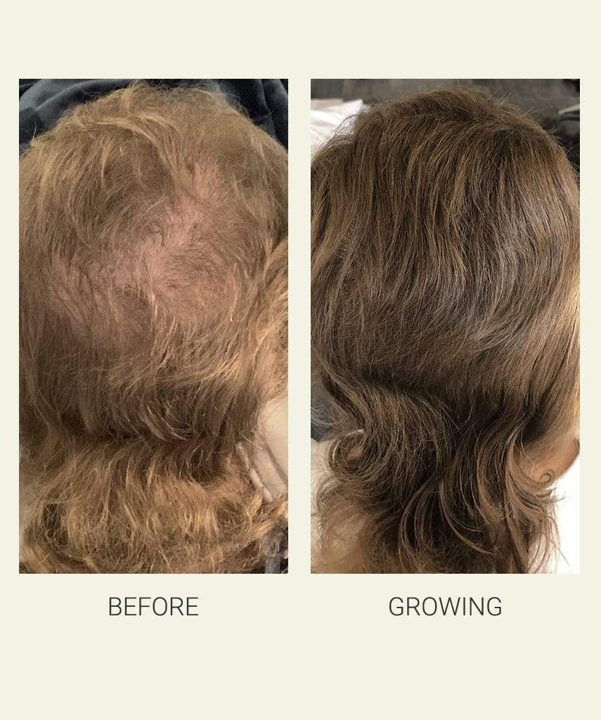 Hair Growth Activating Serum Collective Labs