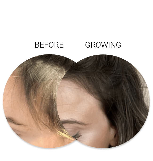 Hair Growth Activating Serum Collective Labs