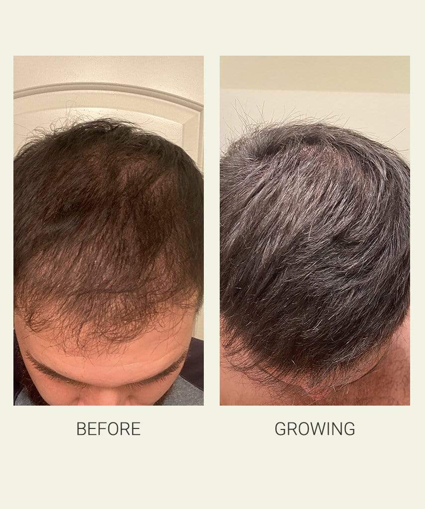 Activating Serum 3Pack Collective Labs